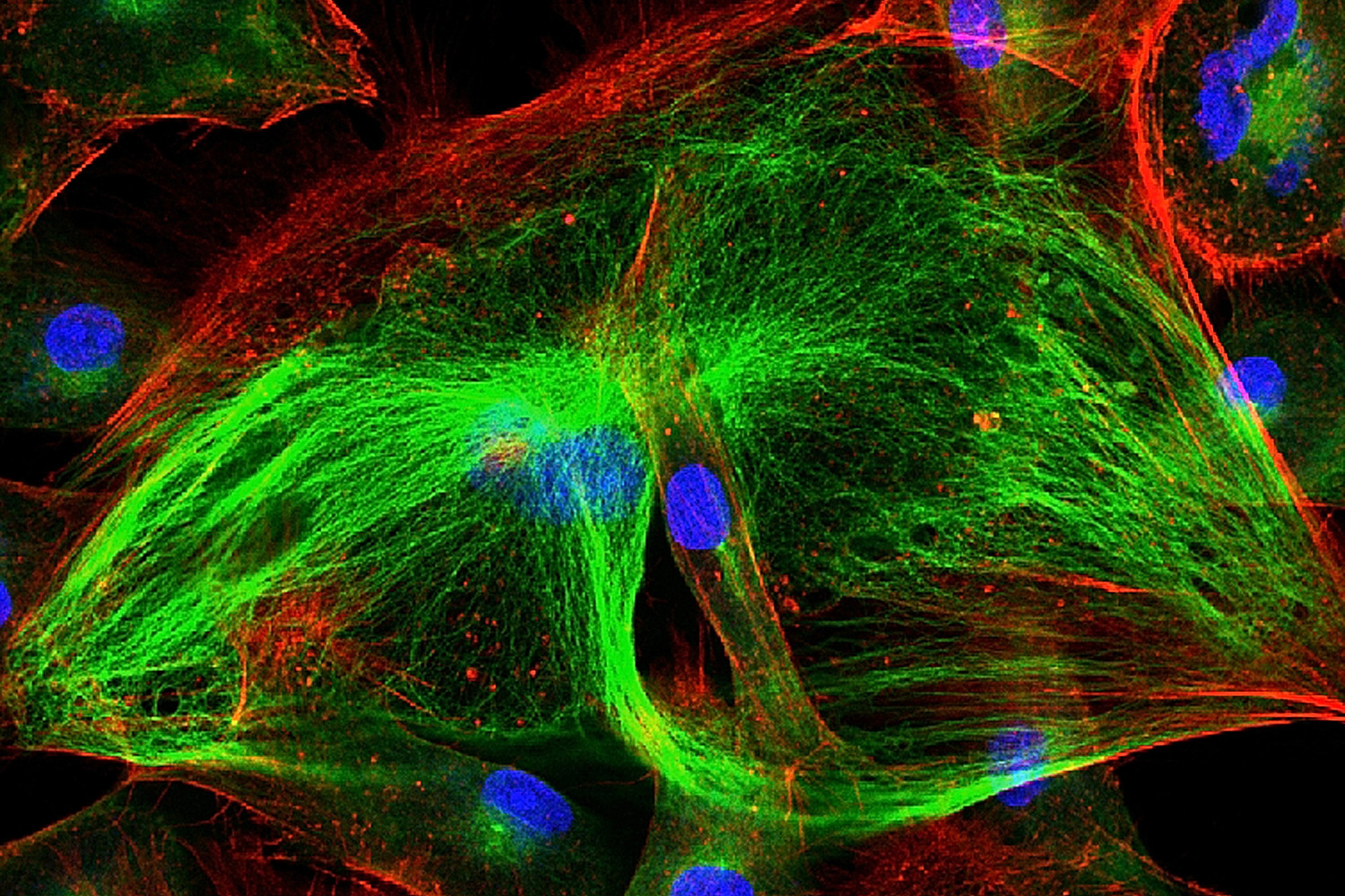 Real fluorescence microscopic view of human skin cells